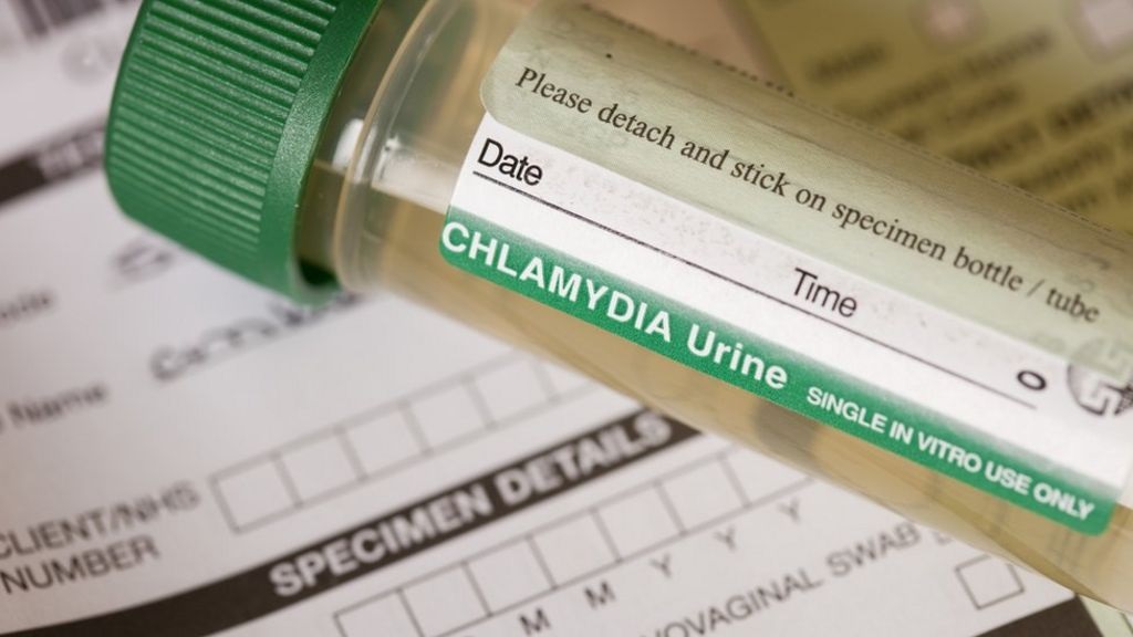 Chlamydia Test: When Should You Order One?