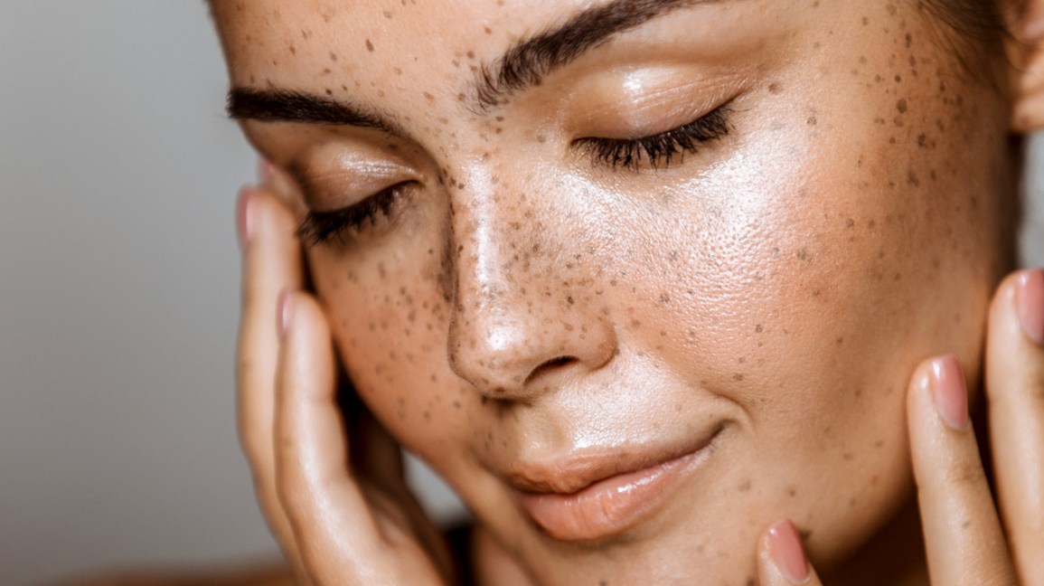5 Home Remedies For Open Skin Pores To Include In Your Skin Care Routine For Oily Skin