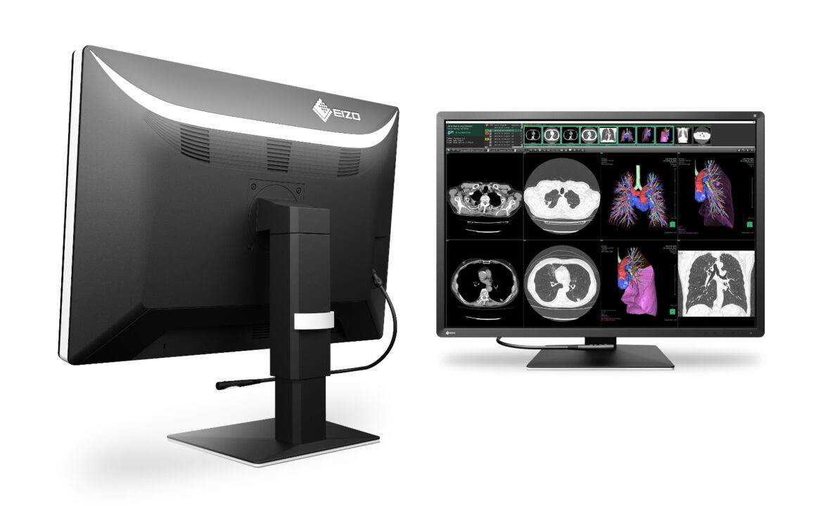 Learn More About Diagnostic Monitors