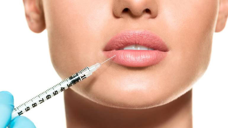 What You Should Know About Lip Injections