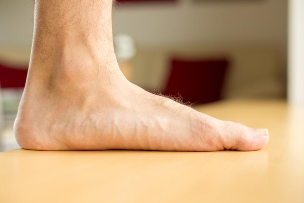 Flat Feet: Everything You Need to Know