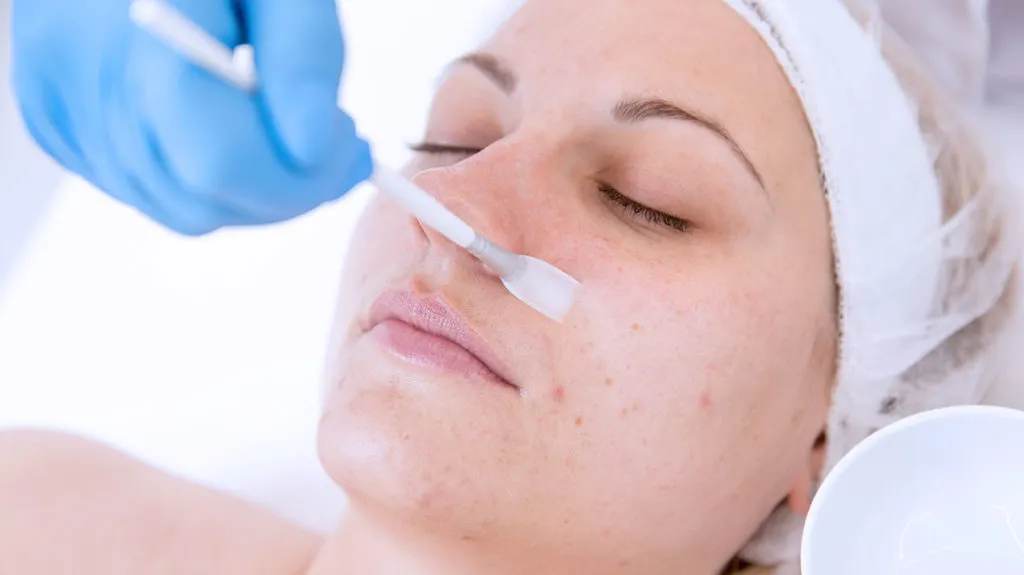 Achieve Your Skin Goals With Chemical Peels