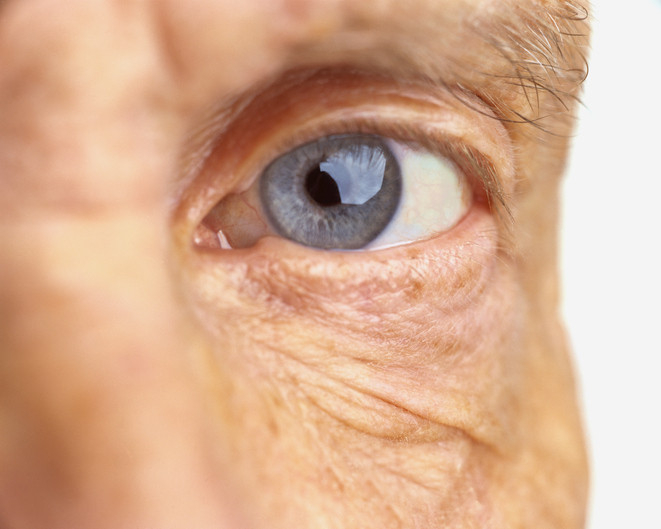 5 Ways Diabetic Eye Disease Can Affect Your Vision