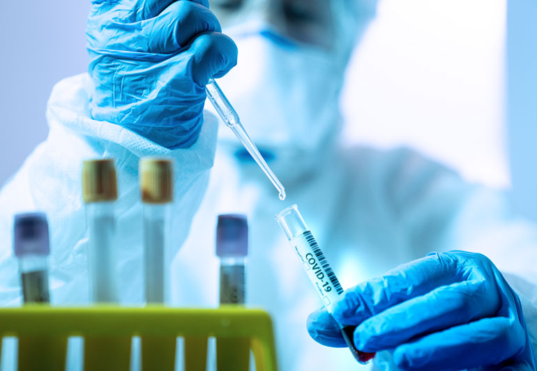 Everything You Need to Know Concerning Antibody Testing as A Way of Testing For Covid-19