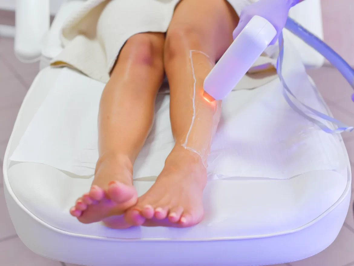 4 Things to Know Before Having Laser Hair Removal