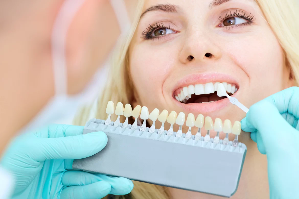 Reasons To Consider Teeth Whitening