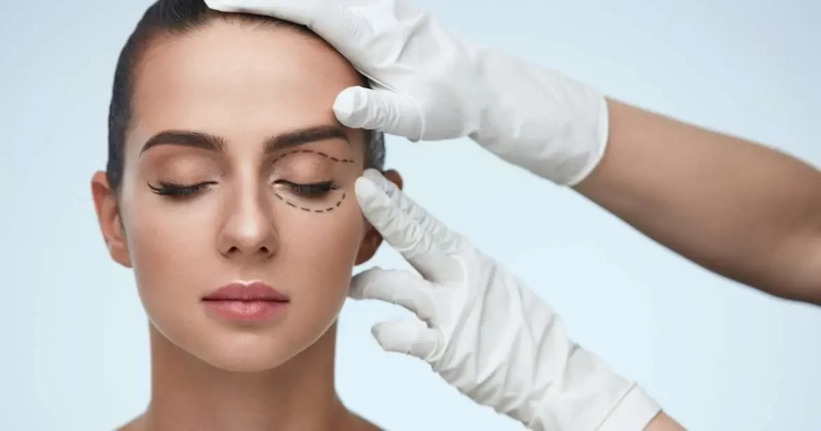 An Ultimate Guide on How to Prepare for Blepharoplasty