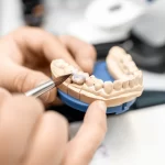 Dental Crowns