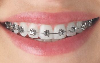 Intervention In Orthodontics