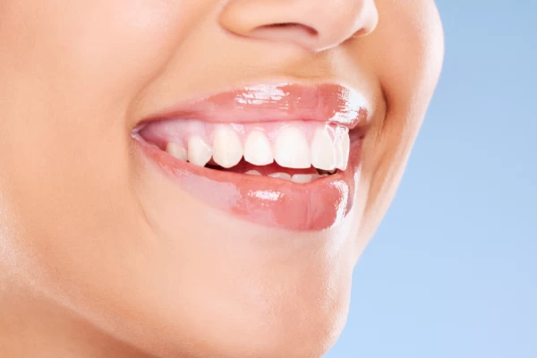 Tooth Whitening