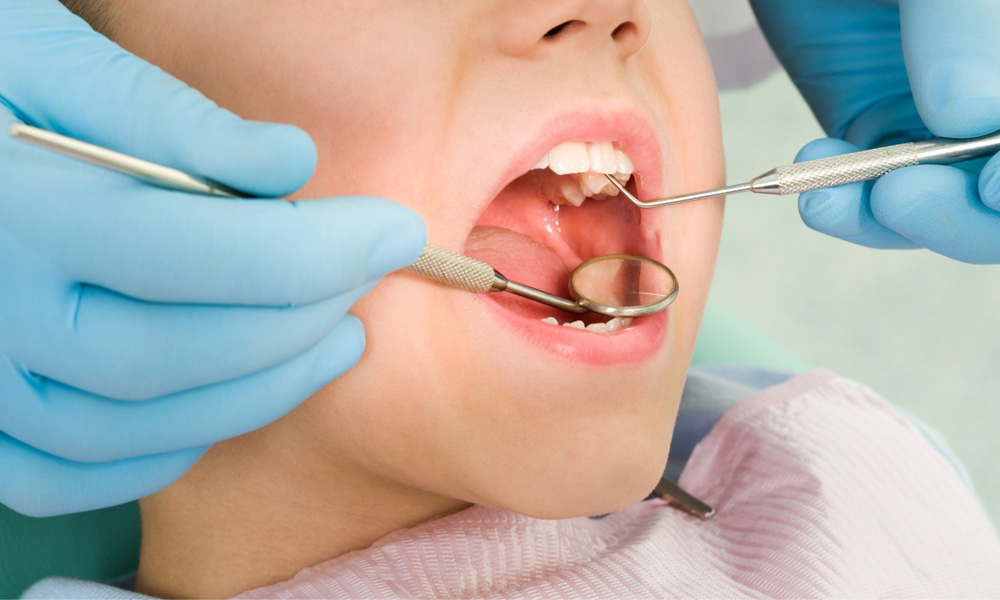 What are the Benefits of Regular Dental Cleanings in San Juan?