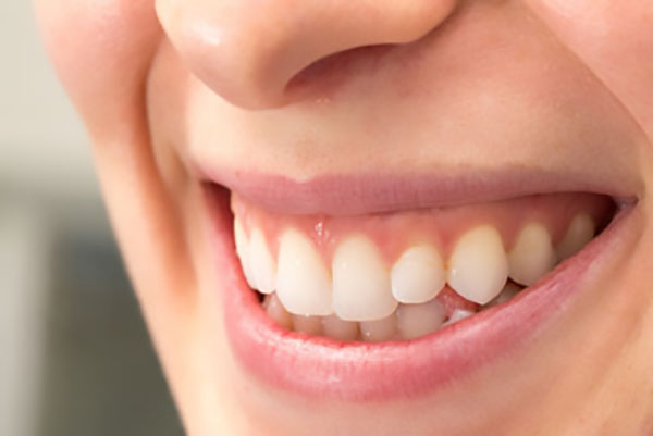 Receding Gums? Solutions That Enhance Both Health and Appearance