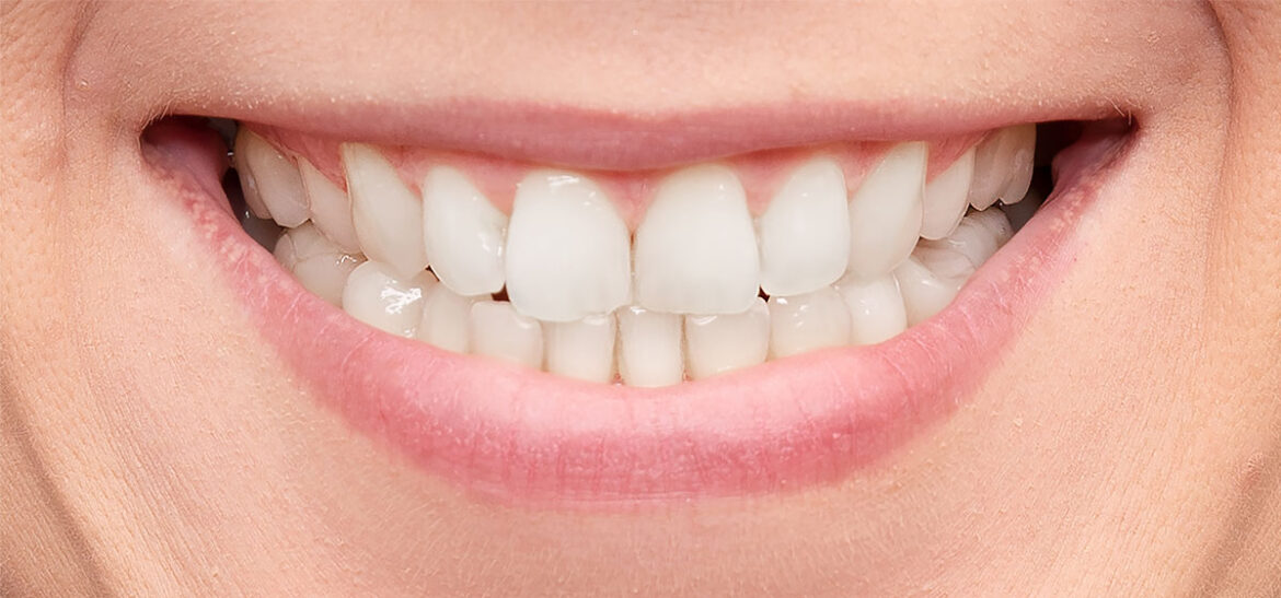 Transform Your Smile: The Benefits of Cosmetic Dentistry