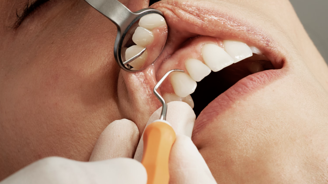 Common Dental Issues in Families and How to Prevent Them